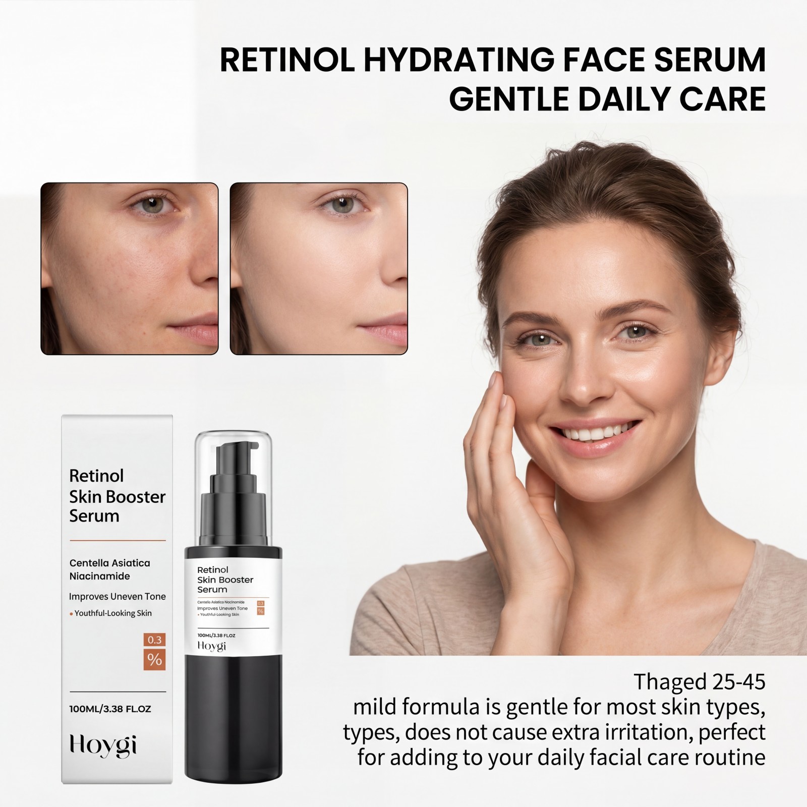100ml Serum z Retinolem do Sty – The Ordinary Serum Hyaluronic Acid recenzja i cena